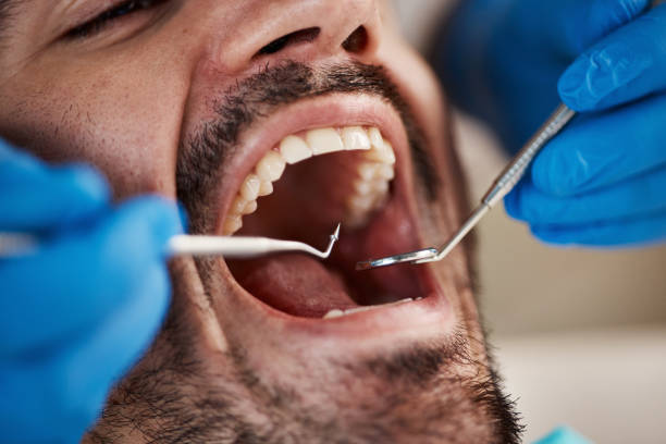 Best Emergency Cosmetic Dentistry in Poseyville, IN
